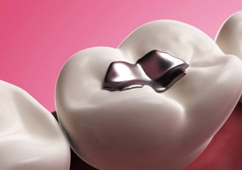 Which Dermal Filler Lasts the Longest?