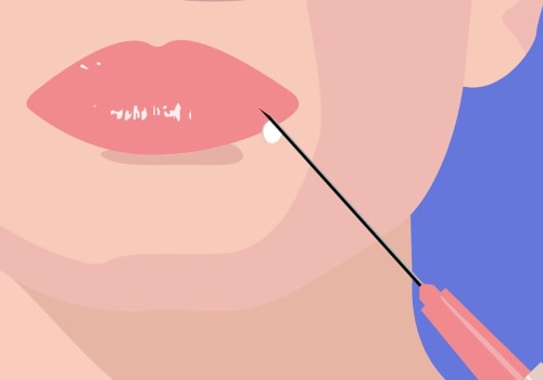 The Best Facial Fillers for a Natural Look