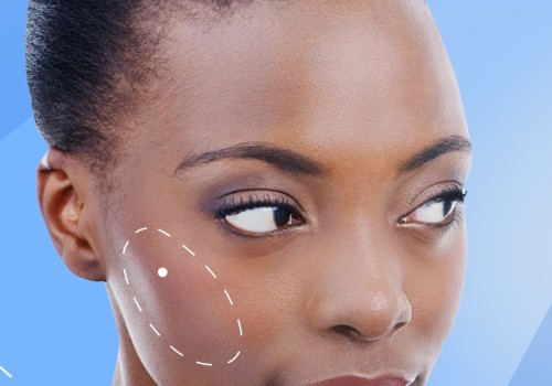 Do Cheek Fillers Feel Hard at First? An Expert's Perspective