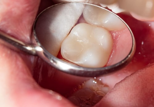 Are You Experiencing an Infection from Your Filler?