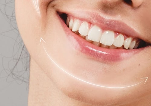 How Long Does a Restylane Syringe Last?