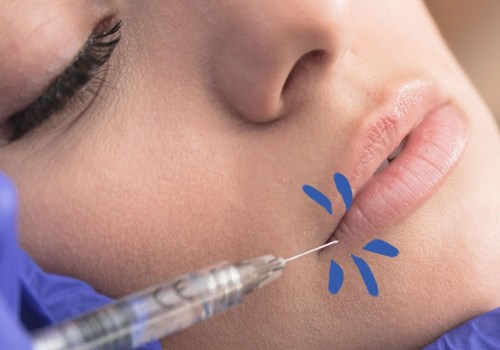 Who Can Administer Botox and Fillers in the USA?