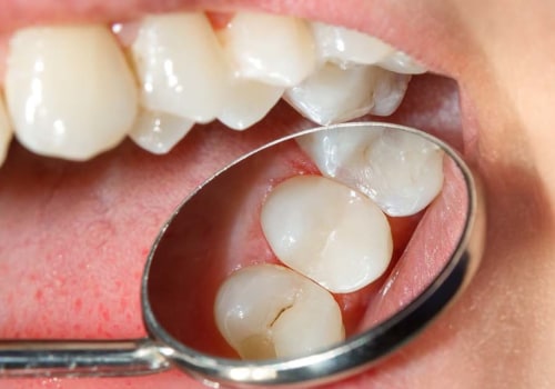 What is the Most Durable Filling for Your Face?